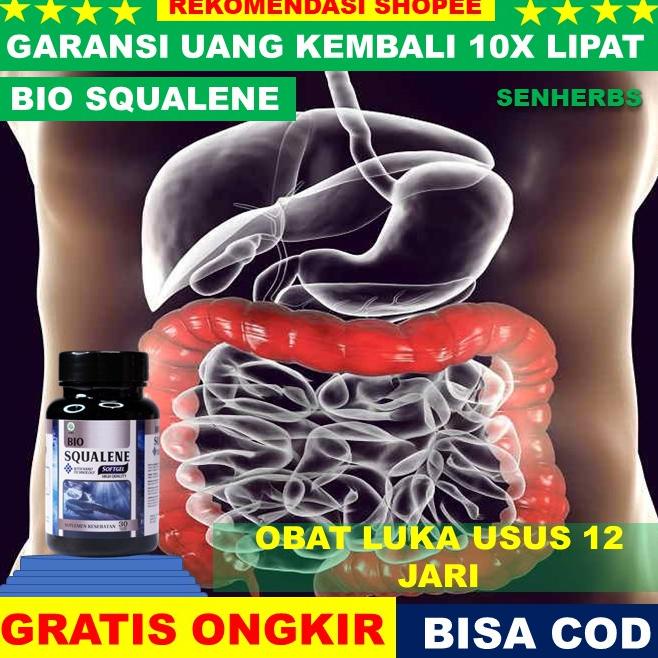 Obat Luka Usus Obat Tukak Usus 12 Jari Alami, Obat Usus Luka, Obat Usus Buntu, Obat Usus Infessi Usu