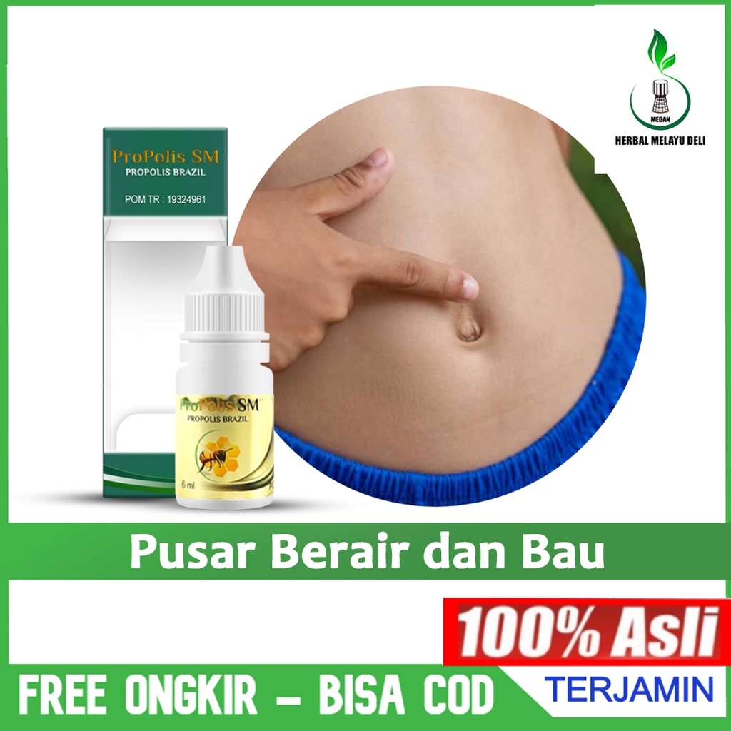Propolis SM Obat Pusar Berair dan Berbau Tidak Sedap Pusar Bernanah Infeksi di Dalam Pusar