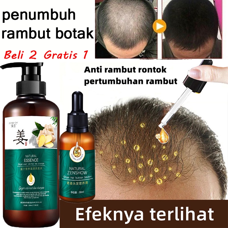 penyubur rambut pria Shampo Penumbuh Rambut Cepat Serum Rambut Rontok Botak Rontok Penumbuh Rambut P