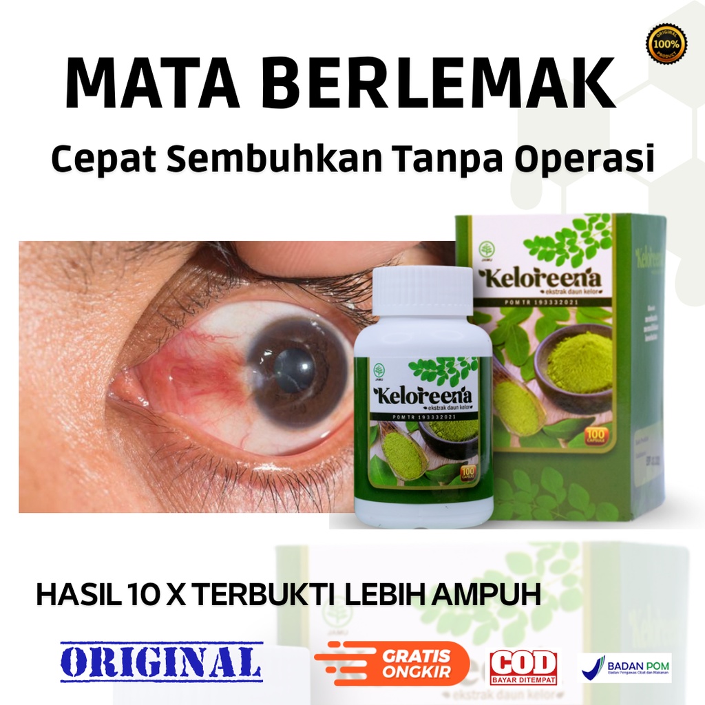 Obat Mata Berlemak - Obat Mata Berlemak Pterigium - Obat Pterigium - Obat Pterygium - Pembersih Mata