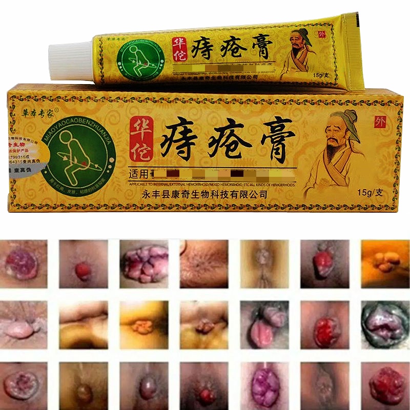 【ORIGINAL】Krim wasir huatuo, efektif menghilangkan wasir, menghilangkan benjolan, wasir dalam, wasir luar, wasir campuran, gatal pada anus, luka pada lubang anus, krim herbal, tanpa efek samping