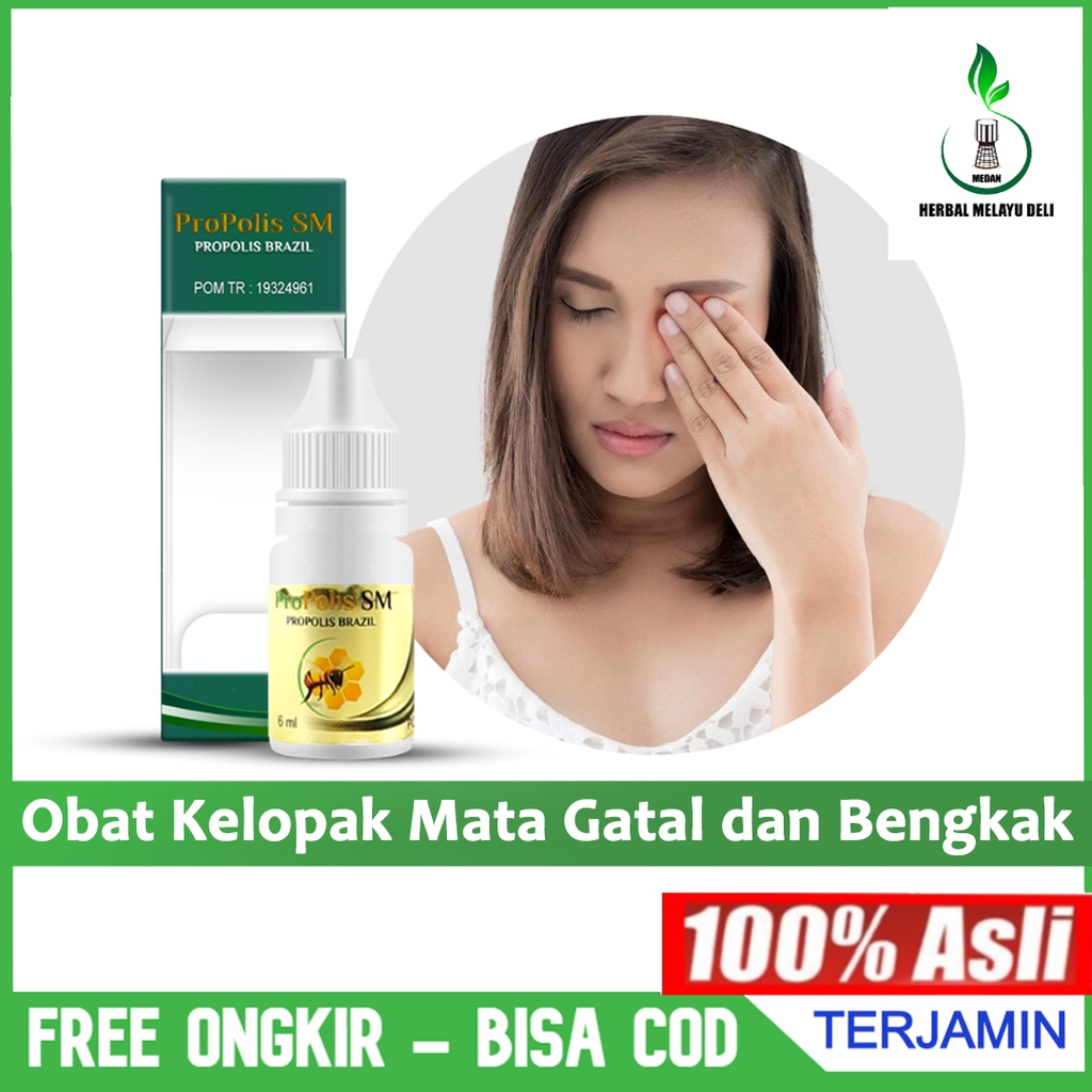 Obat Kelopak Mata Gatal Bengkak Infeksi Kelopak Mata Iritasi Mata Peradangan pada Mata Blefaritis