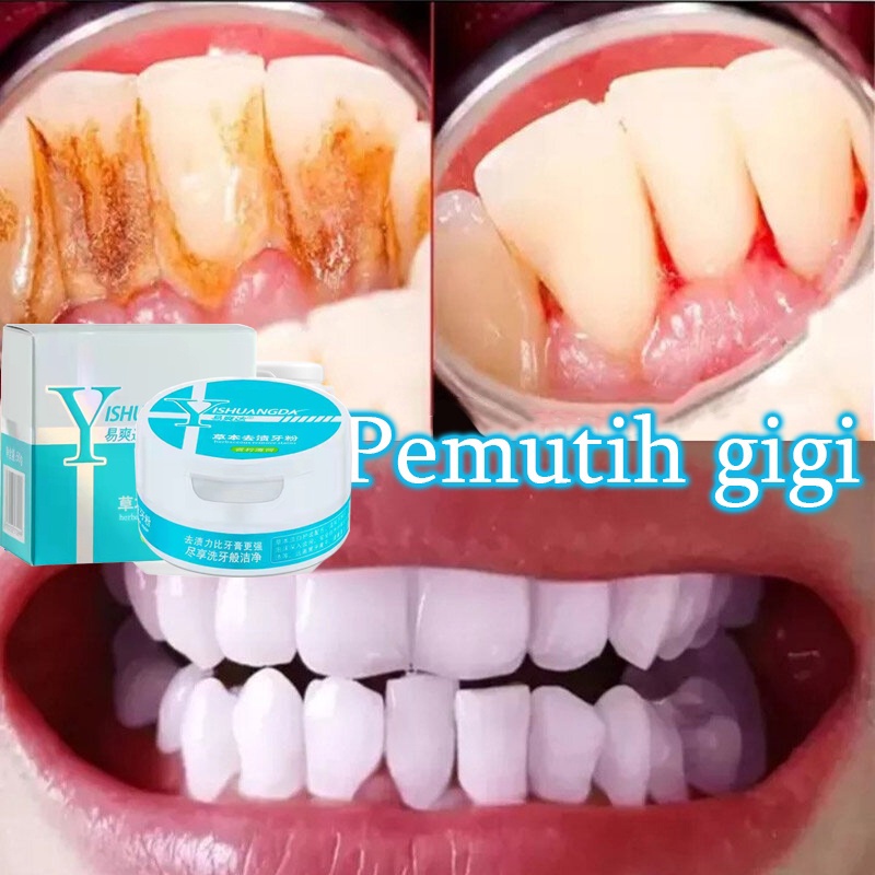 Bubuk Pemutih Gigi Pembersih karang gigi Pemutihan gigi50g Alat Pemutih Gigi Penghapusan Noda Plak K