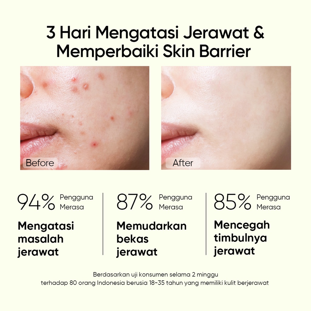 SKINTIFIC 2pcs Set | 5% AHA 5%BHA 1% PHA Exfoliating Toner 80ml + 2% Salicylic Acid Anti Acne Serum 20ml