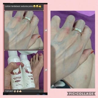 [ PROMO TOKO BARU ] LOTION INJEKSI SIANG I LOTION PEMUTIH BADAN I HB DOSTING I LOTION INJEKSI 3000 G