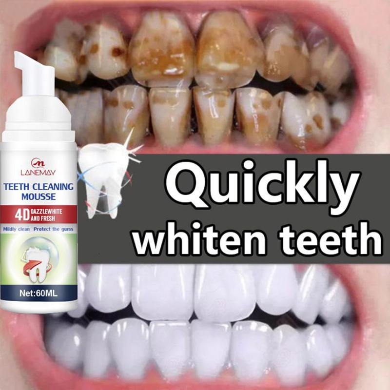 Pembersih karang gigi Pemutih gigi Alat pembersih karang gigi Odol pemutih gigi dan karang gigi Efek