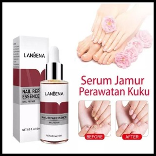 Jual New Obat Kuku Jamur Dan Rusak Lanbena 12Ml Perawatan Kuku Serum ...