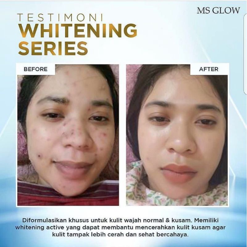 PAKET WAJAH WHITENING + SERUM LUMINOUS MS GLOW ORIGINAL (SUDAH BER BARCODE)