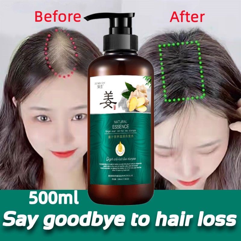 Zhenxiu Ginger Shampo Penumbuh Rambut / Sampo Jahe Anti Rontok Anti Ketombe Gatal / Cairan Essence Serum Jahe Ginger Serum Obat Vitamin Penumbuh Rambut