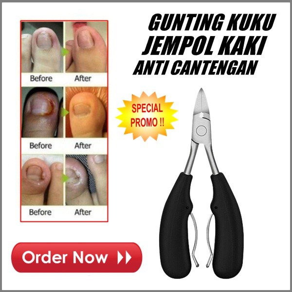 Gunting Kuku Kaki Jempol Kutikula Alat Potong Kuku  Jempol kaki Stainless Ori