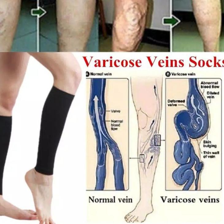 Harga Bersaing--korset lengan pelangsing lengan korset lengan magnetic korset paha korset betis kors