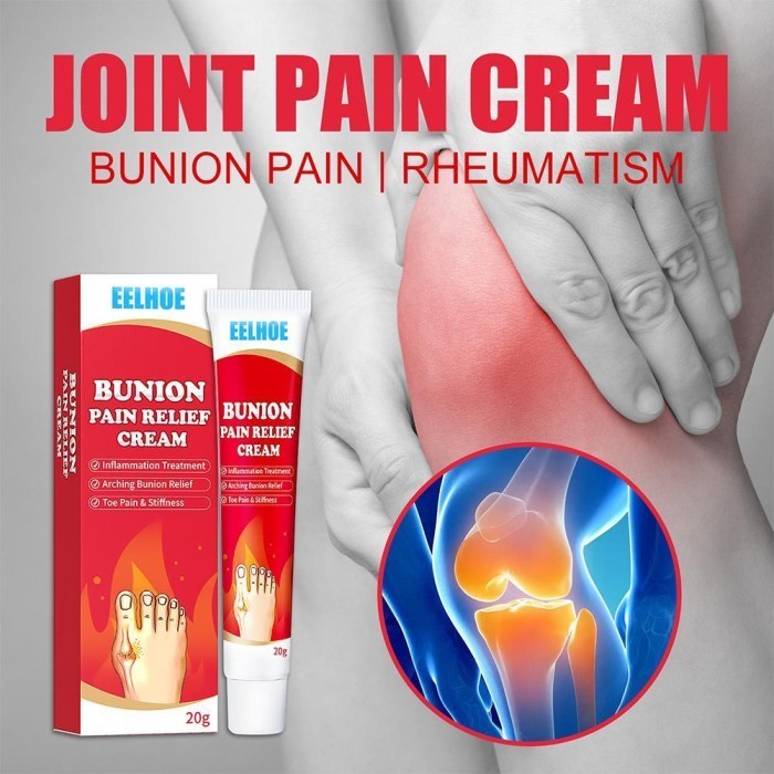 BUNION CREAM ATASI NYERI JARI FN
