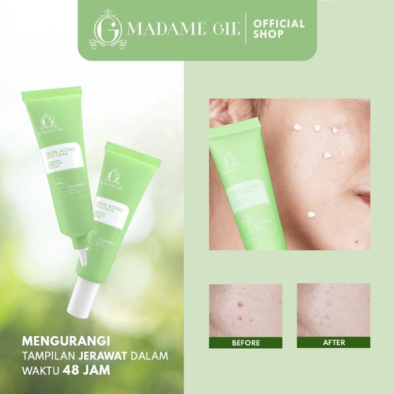 LIZBEAUTY - Madame Gie Madame Skin Acno Spot Cream - Acno Cream