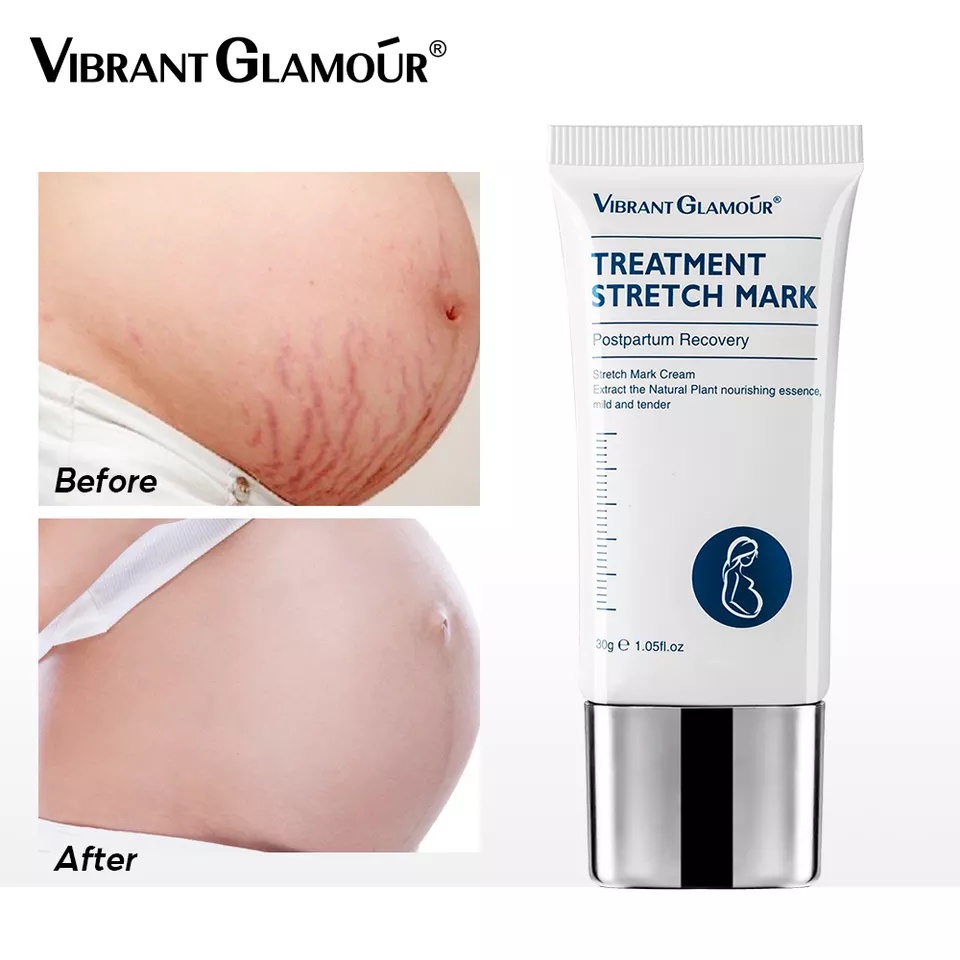 Vibrant Glamour Stretch Mark Treatment Cream