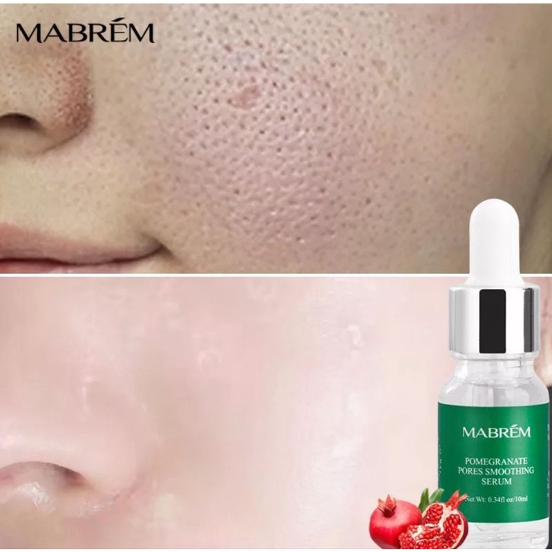 MABREM Face Serum Hyaluronic Acid Shrink Pores Regeneration Moisturizing Anti-Aging Skin Care Face Cream Acne Essence 10ml -Wajah Glowing Pemutih Mengecilkan Pori Anti-Penuaan Pelembab Wajah Esensi Perawatan Kulit Kering