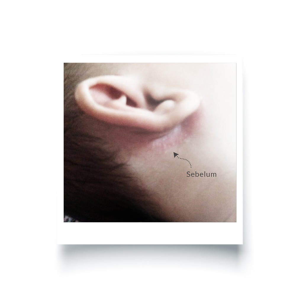 Bambi Baby Diaper Rash Cream 50ml | Krim Ruam Popok Pada Bayi Kulit Normal - Sensitif | Krim Area Lipatan | Mencegah Iritasi Ringan