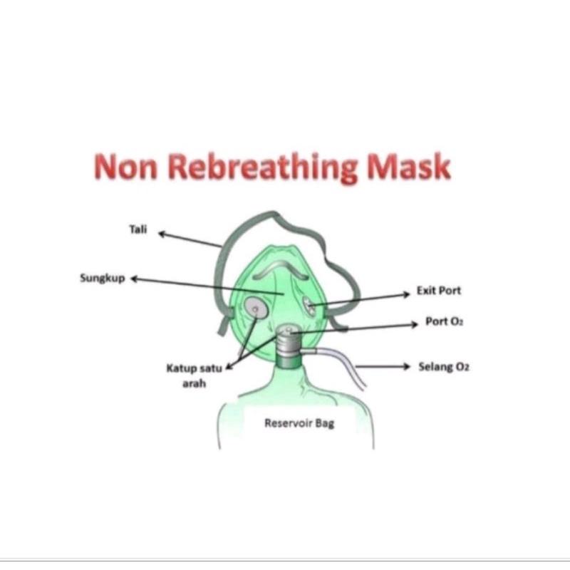 Masker Oksigen Non Rebreathing Dewasa GEA