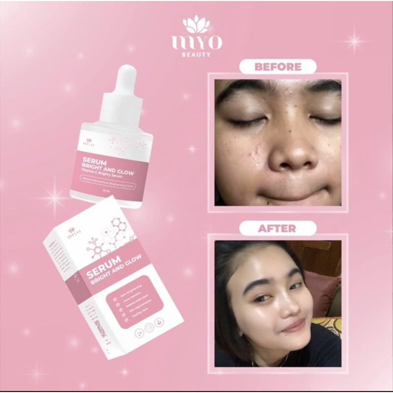 SERUM MYO JERAWAT ORGANIK MAYRA SERUM WAJAH BRIGHT &amp; GLOW SERUM