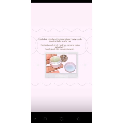 Obat penghilang strechmark