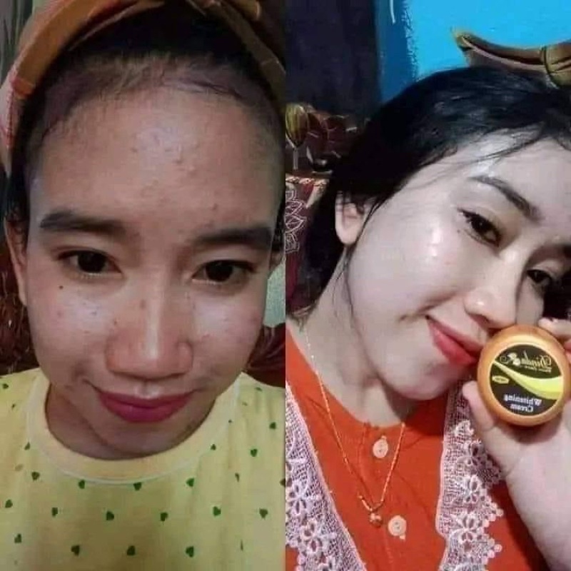 CREAM DINDA SKINCARE