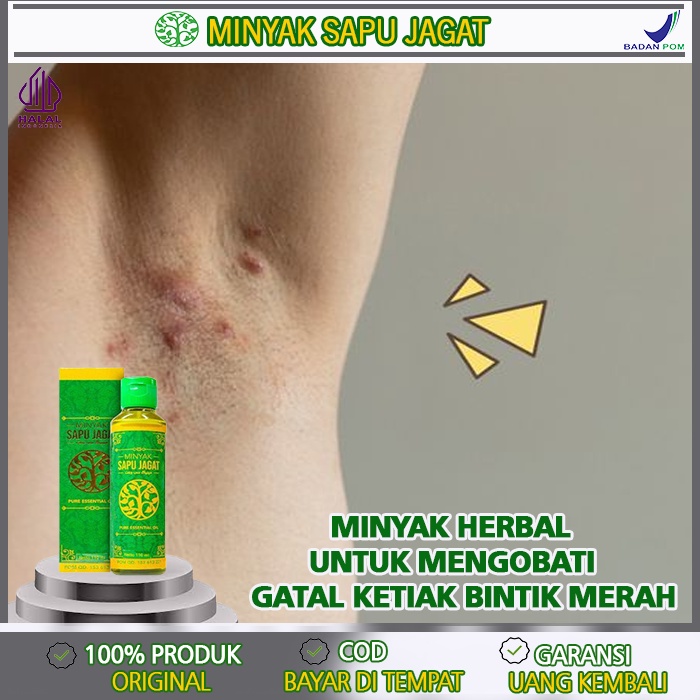 Obat Ketiak Gatal dan Muncul Bintik-Bintik, Obat Ketiak Gatal - Gatal Merah Pada Ketiak, Minyak Oles