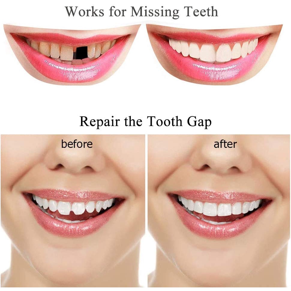 Penambal Gigi 2g - Temptooth Gigi Palsu 2g - Temporary Tooth Repair Kit Denture Teeth 2g