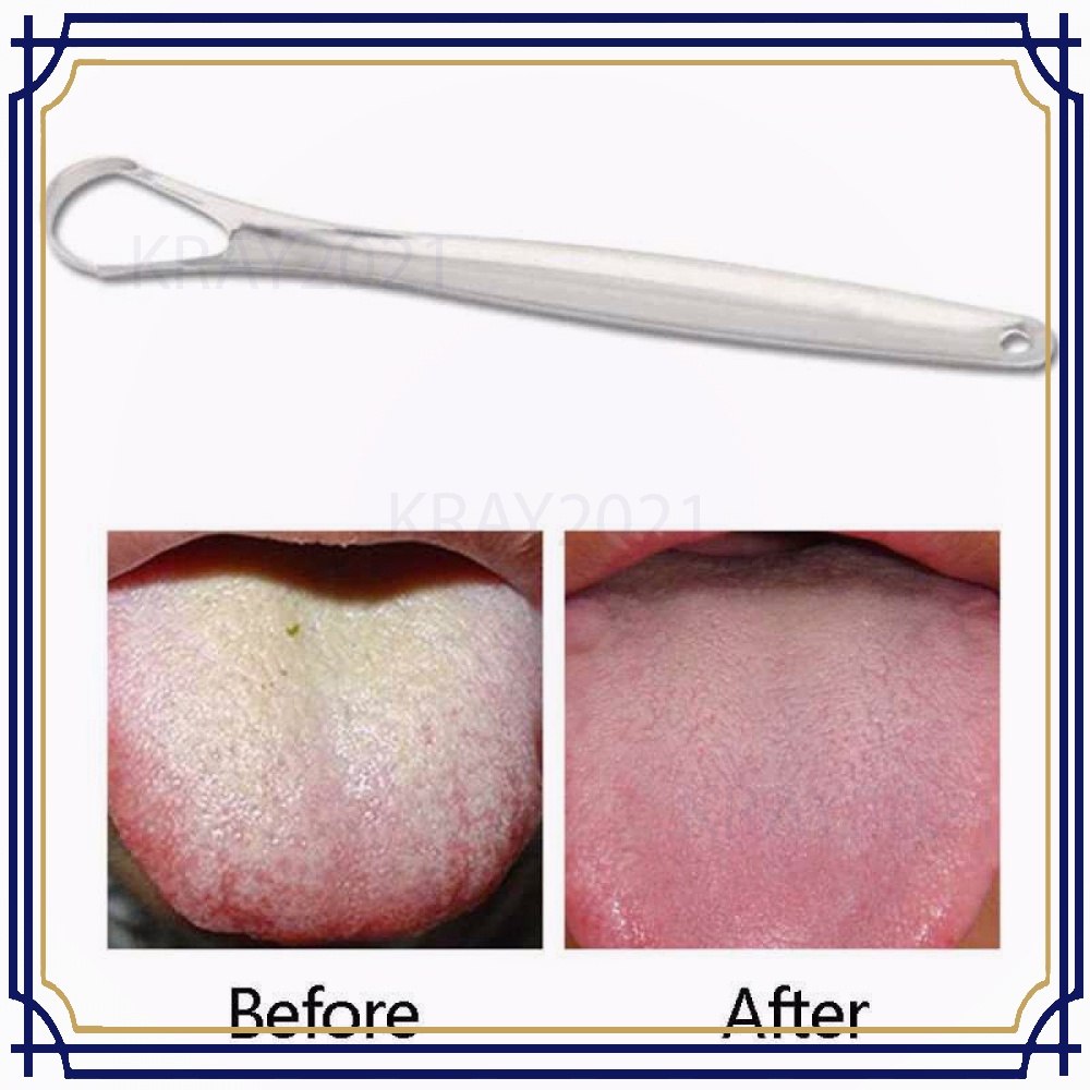 Pembersih Lidah Tongue Oral Scraper Cleaner HT883