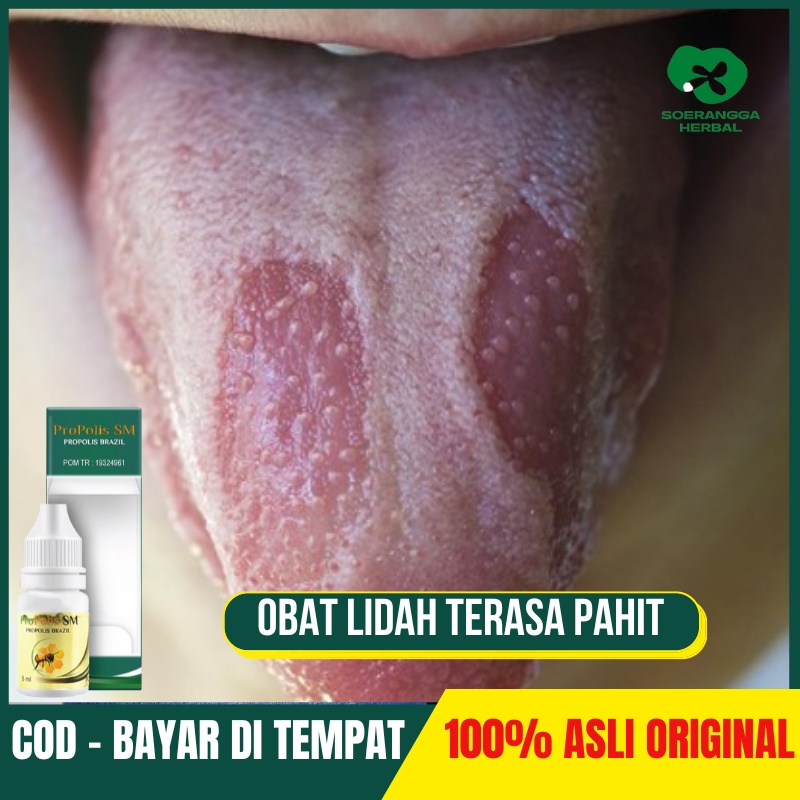Obat Lidah Terasa Pahit, Mulut Pahit, Lidah Putih, Benjolan di Bawah Lidah, Tumor Lidah, Ranula Lida