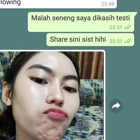 Terbaik ナ SERUM AISH KOREA  AISH SERUM ORIGINAL | SERUM AISH ORIGINAL | AISH SERUM KOREA BPOM / AISH