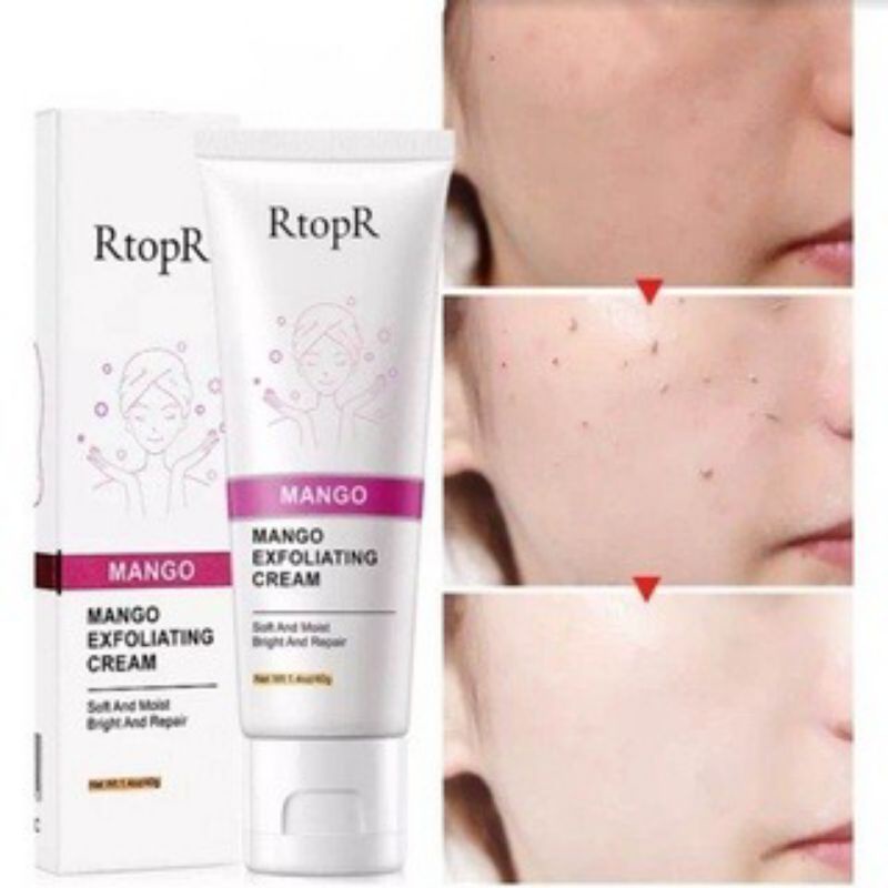 RTOPR MANGO Exfoliating Cream Whitening Moisturizer Repair Facial Scrub Peel/ Scrub / Mask / Gentle 