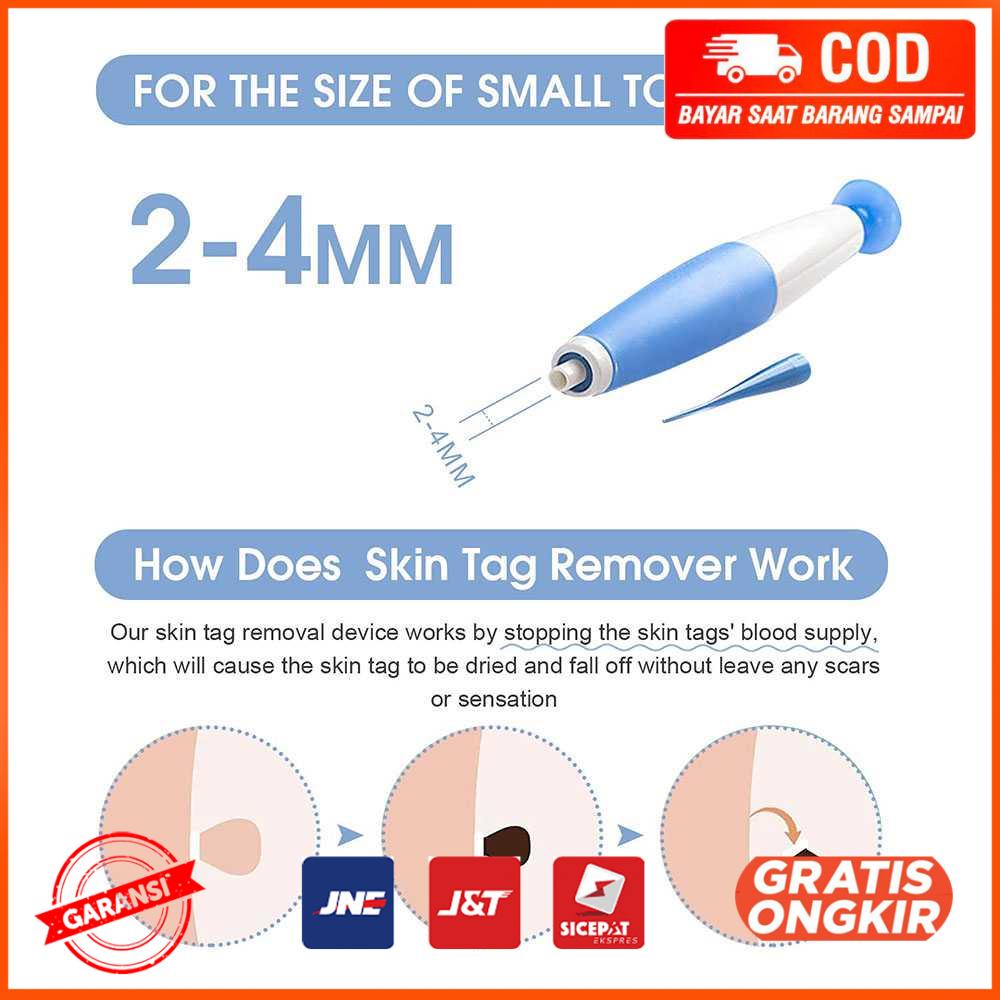 Alat Penghilang Kutil Painless Skin Tag Mole Removal Kit LGV40