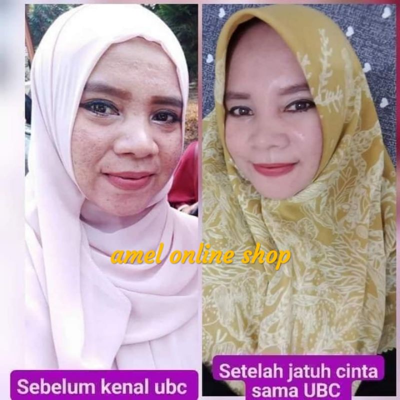 UBC SKINCARE BY UMI ALFATIH