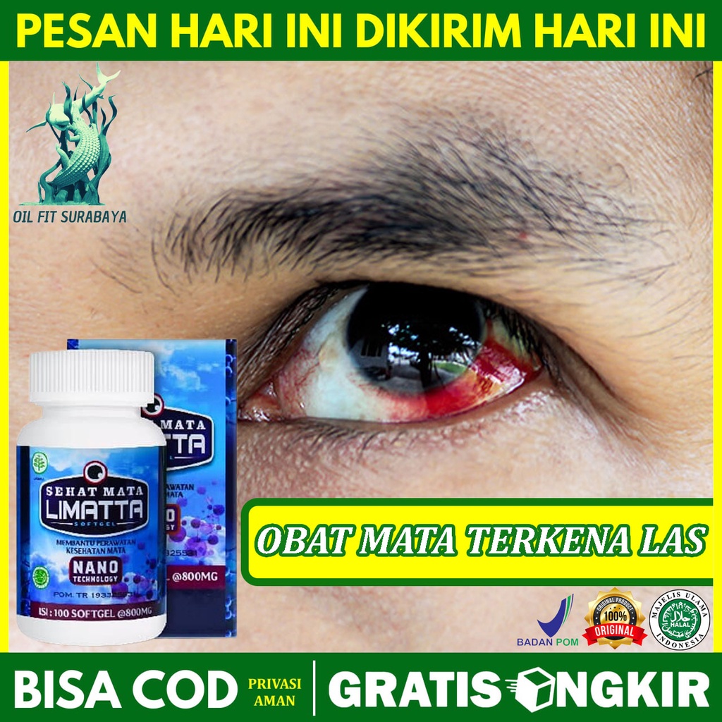 Jual Obat Mata Terkena Las Habis Ngelas Mata Sakit Kena Asap Las