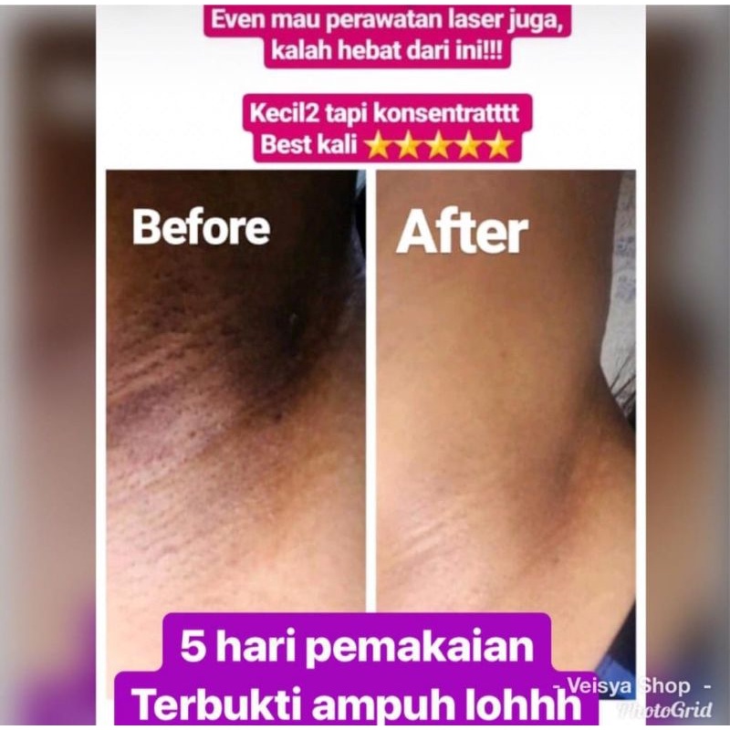 BABY WHITENING CREAM - CREAM KETIAK LEHER LIPATAN DLL