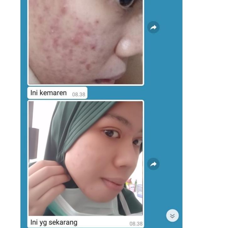COD✔️ADERA SERUM ORIGINAL FACE SERUM ADERA WAJAH ORI UNTUK FLEK HITAM GLOWING ORIGINAL BPOM ASLI 100