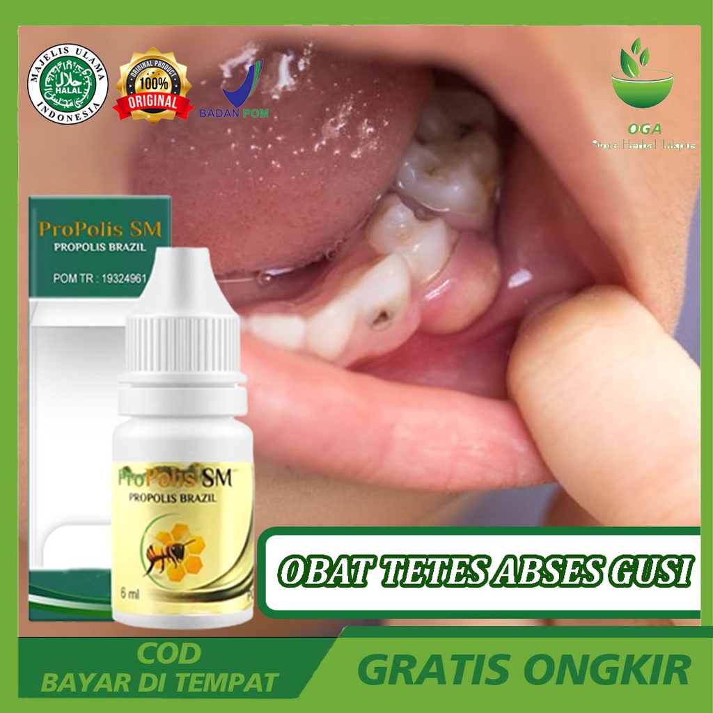 Obat Tetes Abses Gusi - Obat Tetes Polip Gusi - Obat Gusi Bernanah Radang Dan Nyeri Gusi - Obat Gusi