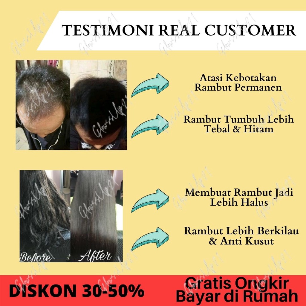 SAMPO PENUMBUH RAMBUT CEPAT BLACK MAGIC KEMIRI SHAMPO BPOM BMKS SHAMPO KEMIRI