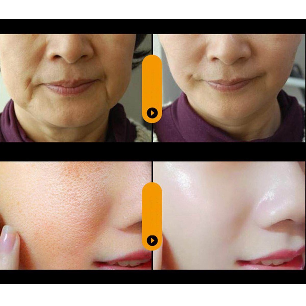 SHINE STAR - Cindynal Niacinamide Serum / Serum Anti Aging / Flek Hitam Tebal / Pencerah Wajah 1 Box Isi 7 Ampul