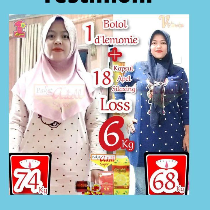 

GRATIS ONGKIR✅d'lemonie Sari Lemon Murni|RA6