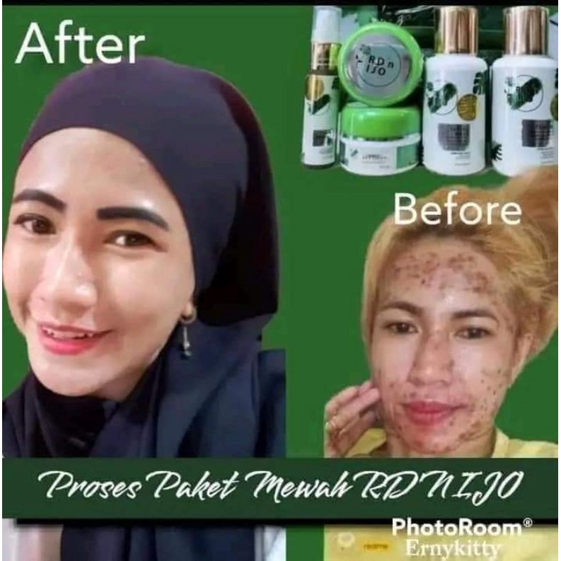 paket wajah rdn ijo/paket mewah/cream rdn ijo paket mewah