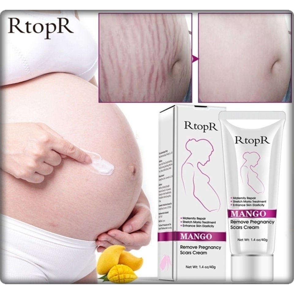 RtopR MANGO Remove Pregnancy Scars Cream Krim Anti Penuaan dan Keriput, Perawatan Stretch Mark, Krim Jerawat Penghilang Bekas Hamil, Krim Pengencang Tubuh