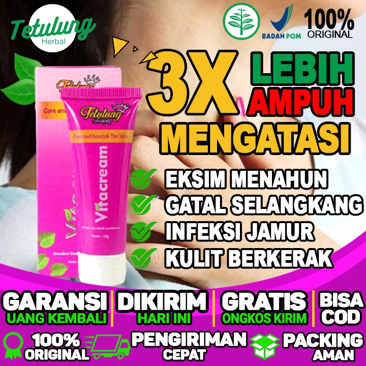 obat eksim obat eksim basah tradisional yang ampuh obat eksim kering dan eksim basah