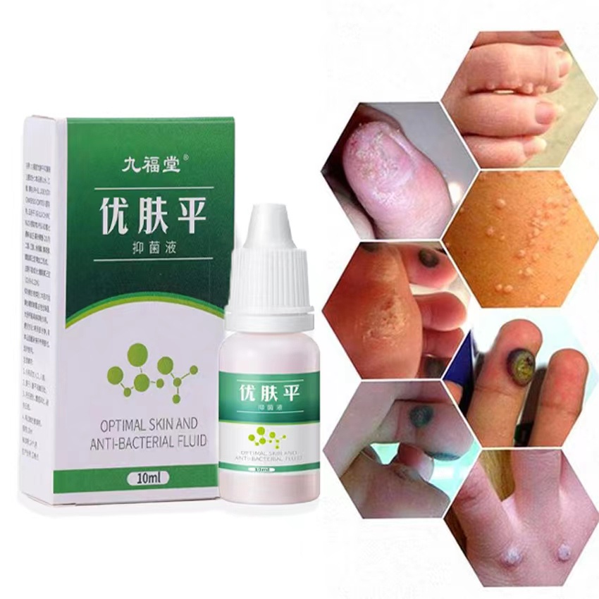 Cairan Obat Untuk Kutil Salep Untuk Kapalan Kaki Cairan Anti Kutil Tangan Dan Kaki Menghilangkan Kutil &amp; Skin Tag Cairan Antibakteri Obat Kutil 10ml Kapalan Di Tangan Dan Kaki Krim Antibakteri Penghilang Tahi Lalat