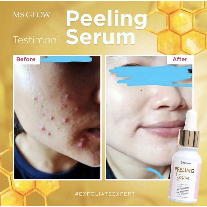 SALE SERUM PEELING MSGLOW