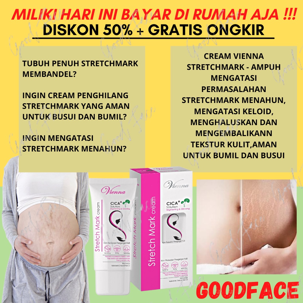 VIENNA CREAM STRETCH MARK ORIGINAL BPOM PENGHILANG STRECHMARK KRIM STRECHMARK IBU HAMIL PENGHILANG BEKAS LUKA PERAWATAN TUBUH