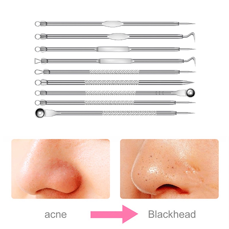 【9 PCS】Alat Penjepit Komedo/Alat Penghilang Komedo Hidung/Alat Penghilang Komedo