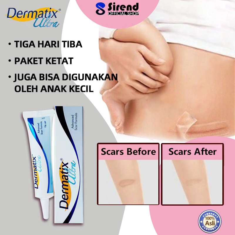 Dermatix Ultra Gel 15g penghilang bekas luka keloid scar perawatan wajah kecantikan krim bekas luka 