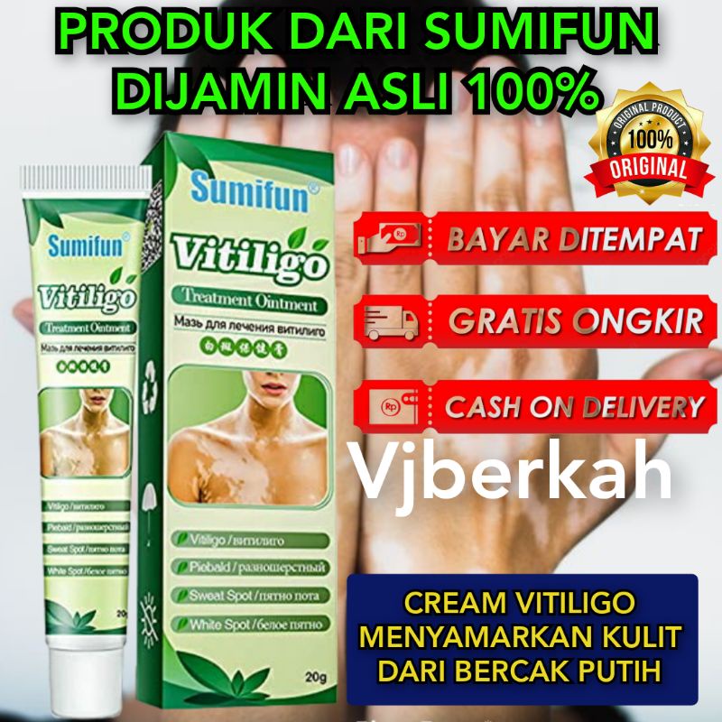 OBAT KRIM/SALEP VITILIGO  PRODUK DARI SUMIFUN VITILIGO AMPUH MENGOBATI BERCAK PUTIH PADA KULIT(vitiligo)