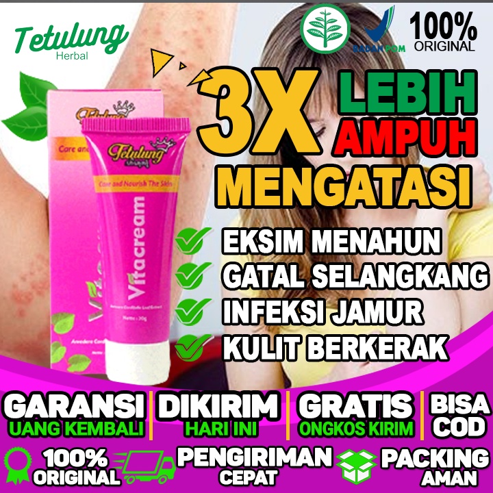 obat eksim saat hamil obat salep eksim basah dan obat eksim kering