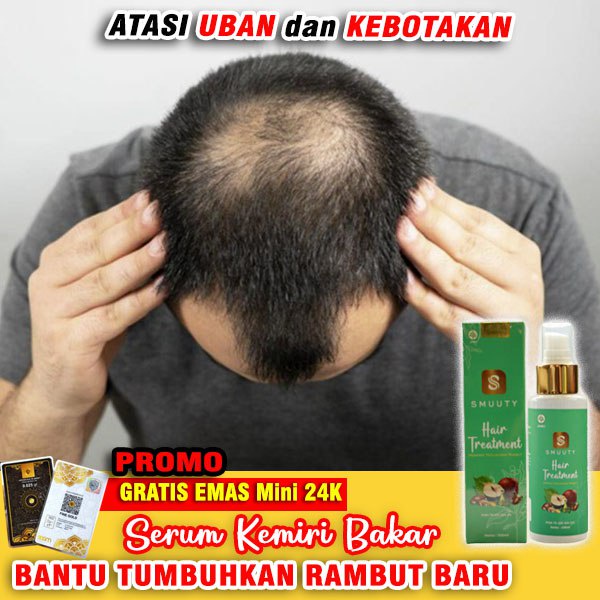 Smuuty Hair Treatment Serum Kemiri Bakar Untuk Rambut Rotokn - Penumbuh Rambut - Penipisna Rambut